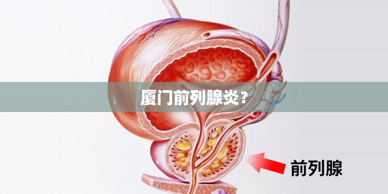 厦门前列腺炎？